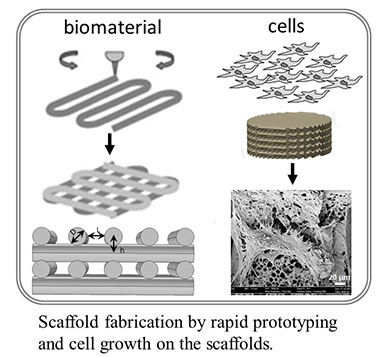 diagram-of-bone-scaffold