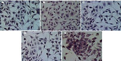 Conversion of cancer cells into brown fat.