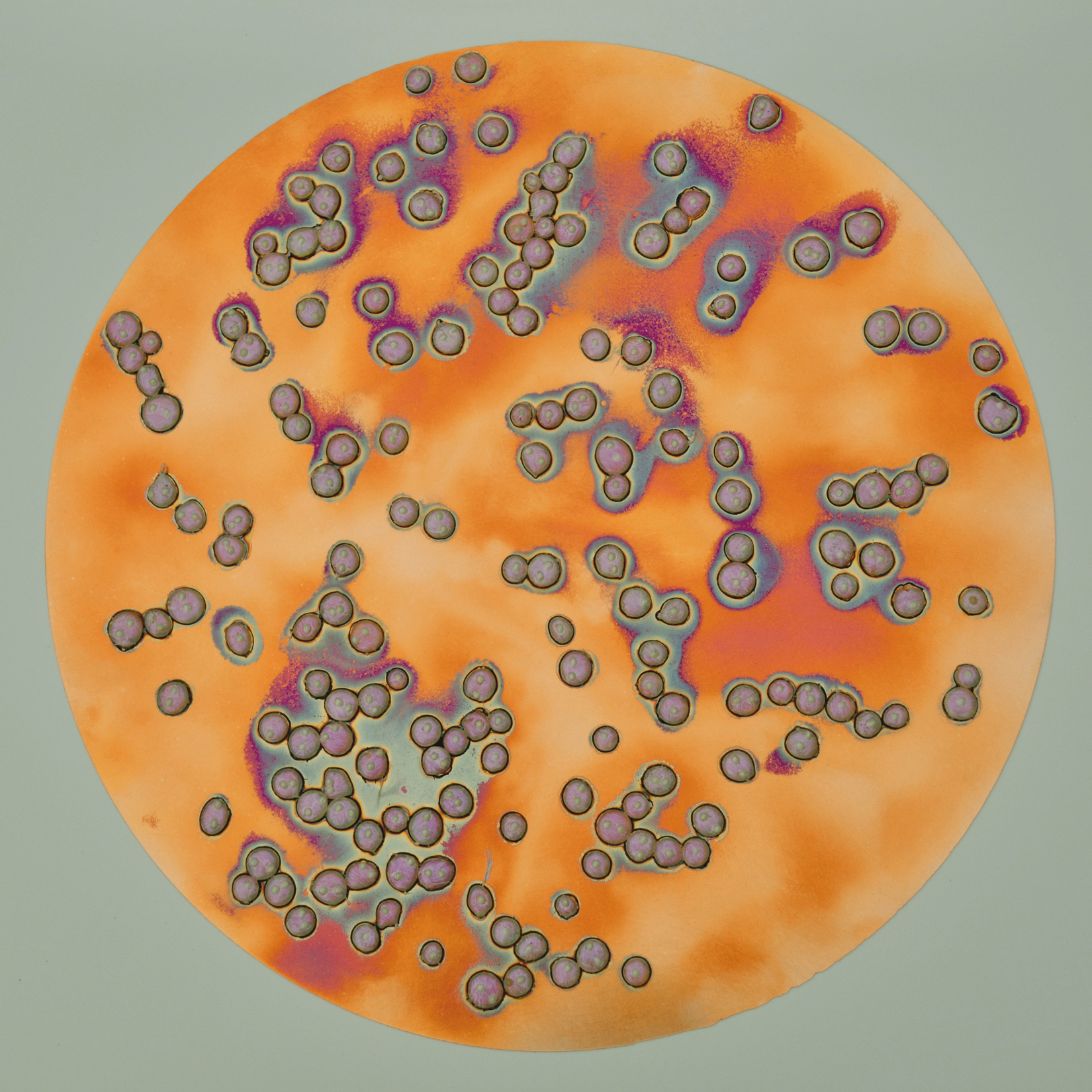 saccharomyces cerevisiae under microscope