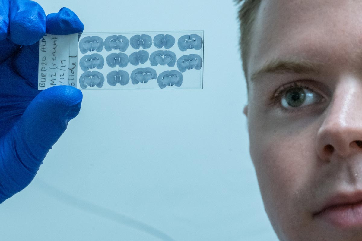 student studying a slide with images of a rat brain